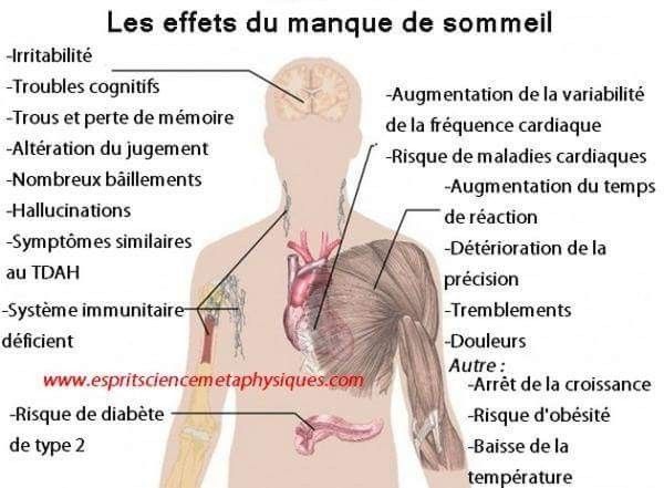 les effets du manque de sommeil 